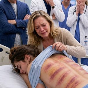 My stepdaughter was brought into the ER unconscious, and my husband calmly told the doctor, “She’s always been reckless. She must have fallen down the stairs again.” I lifted her sleeve and froze when I saw bruises that matched the exact shape of his belt buckle. He leaned toward me and whispered, “She’s not even your biological daughter, so this has nothing to do with you.” I looked up at the security camera and said, “She became my daughter the moment I adopted her, and you just gave my hospital the evidence it needed.”